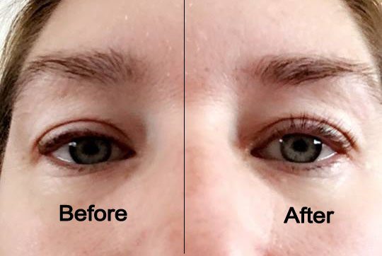 Lash Lift & Tint at cuteicals